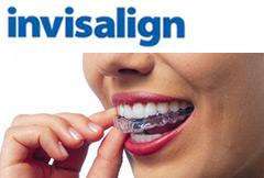 CONHEÇA A INVISALIGN