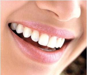 Para ter um sorriso perfeito